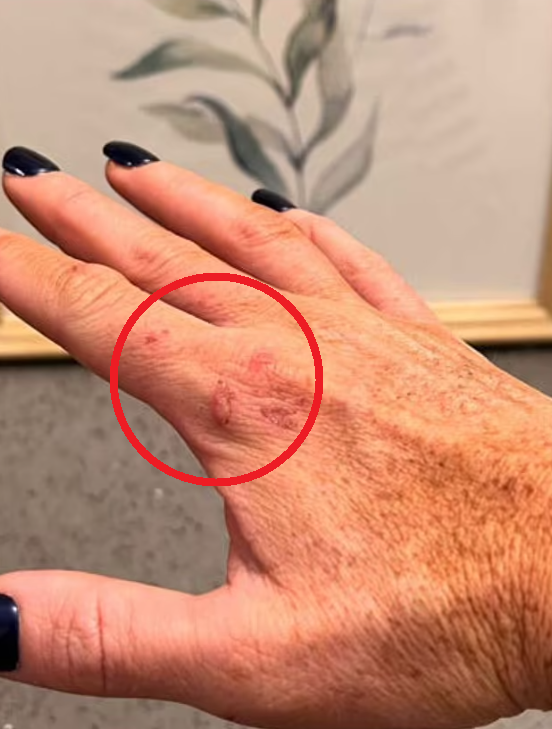 本來溫馴的少年J.F.咬傷母親。(互聯網)