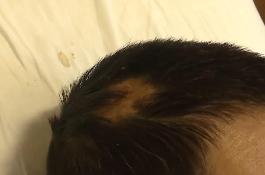 男子形容,升降機把他扔到升降機頂上又「啪」地扔回來。(微博)