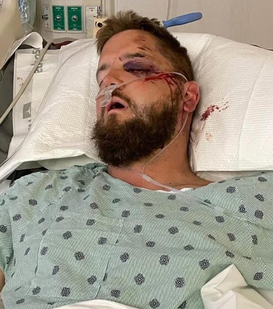 新郎Aric Hutchinson意外後昏迷入院。(X)