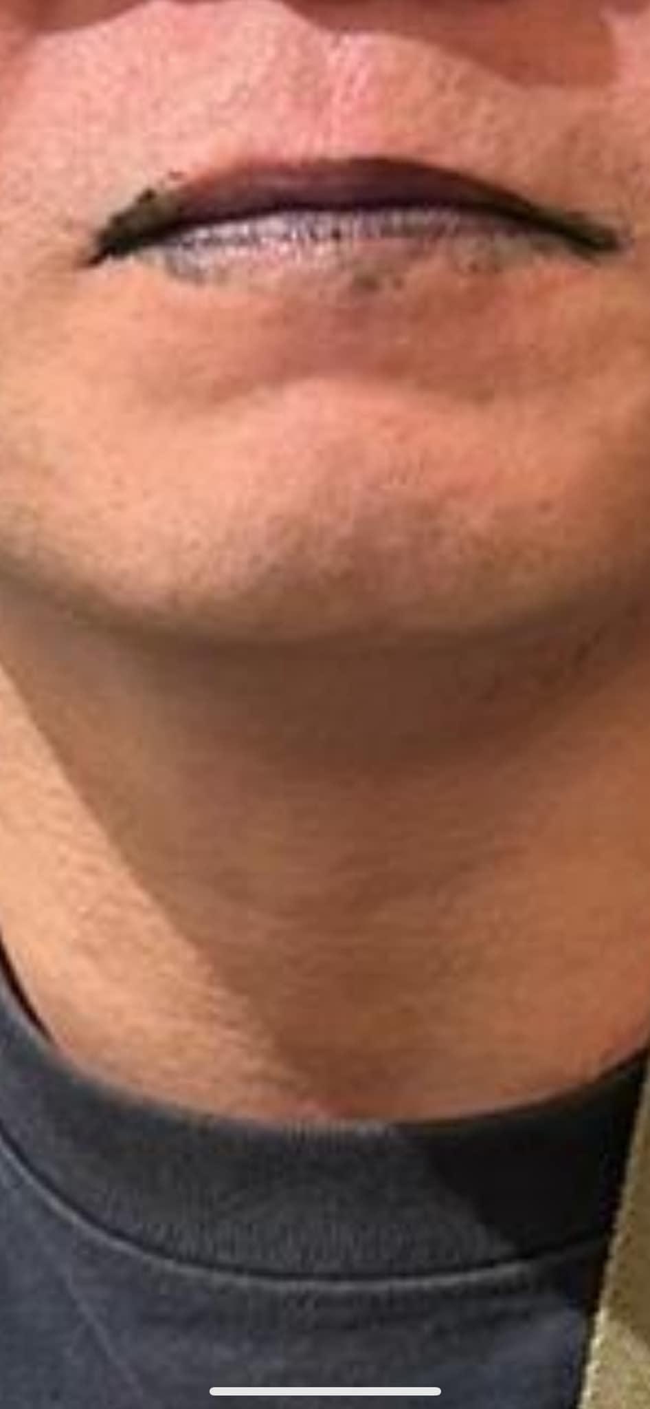 事主食用蛋糕後唇部染黑。(FB「新香港黑店大全」)