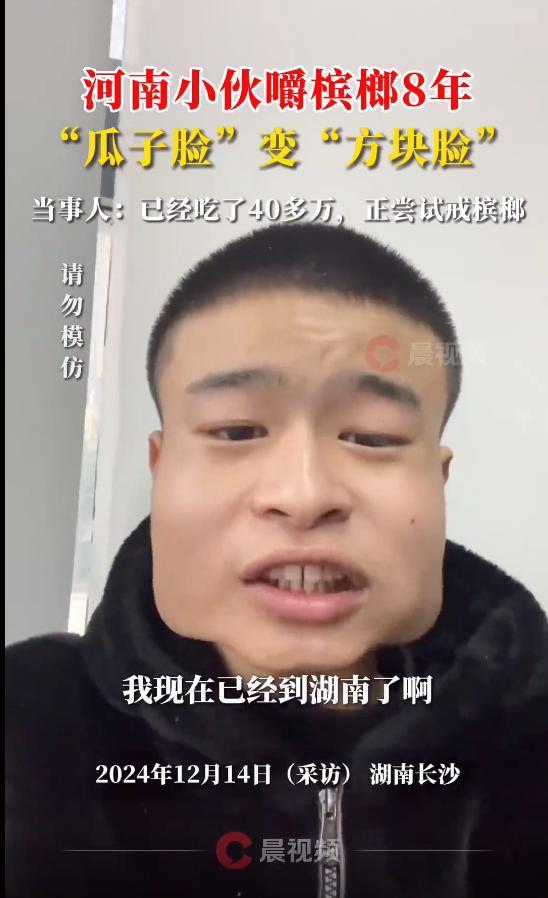 河南漢因食檳榔太多令外表出現異樣,他建議大家少吃或不吃檳榔。