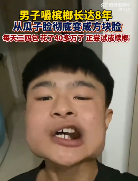 河南漢8年來因食檳榔用了40多萬人民幣。