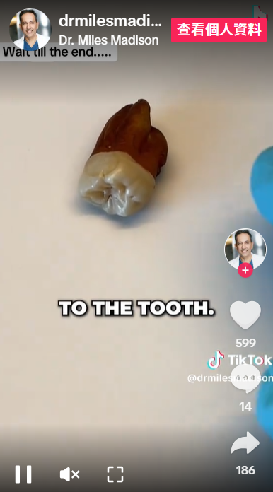 咖啡會把牙染成啡色。(互聯網)