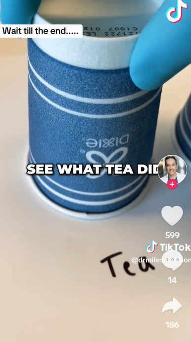 茶泡牙的結果如何?(互聯網)