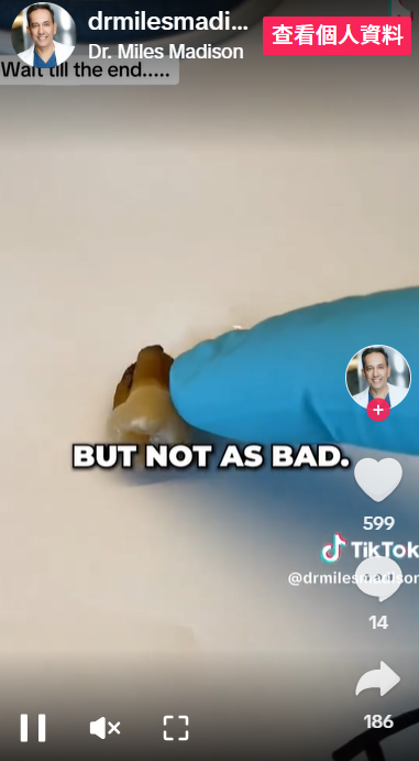 茶跟咖啡一樣會把牙染成啡色,但相對較淺。(互聯網)