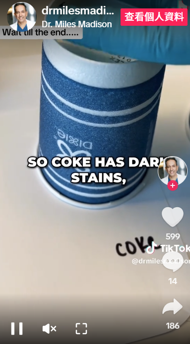 可樂泡牙結果如何?(互聯網)