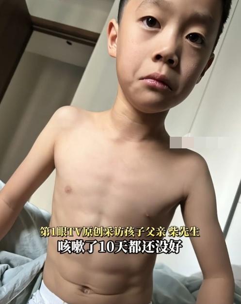男童父親表示,孩子的身材太瘦,咳嗽時,身上出現腹肌的線條會變得更加明顯。(微博)