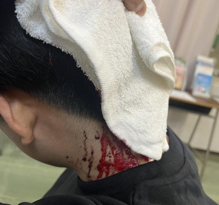 有學生頭部流血。(網上圖片)