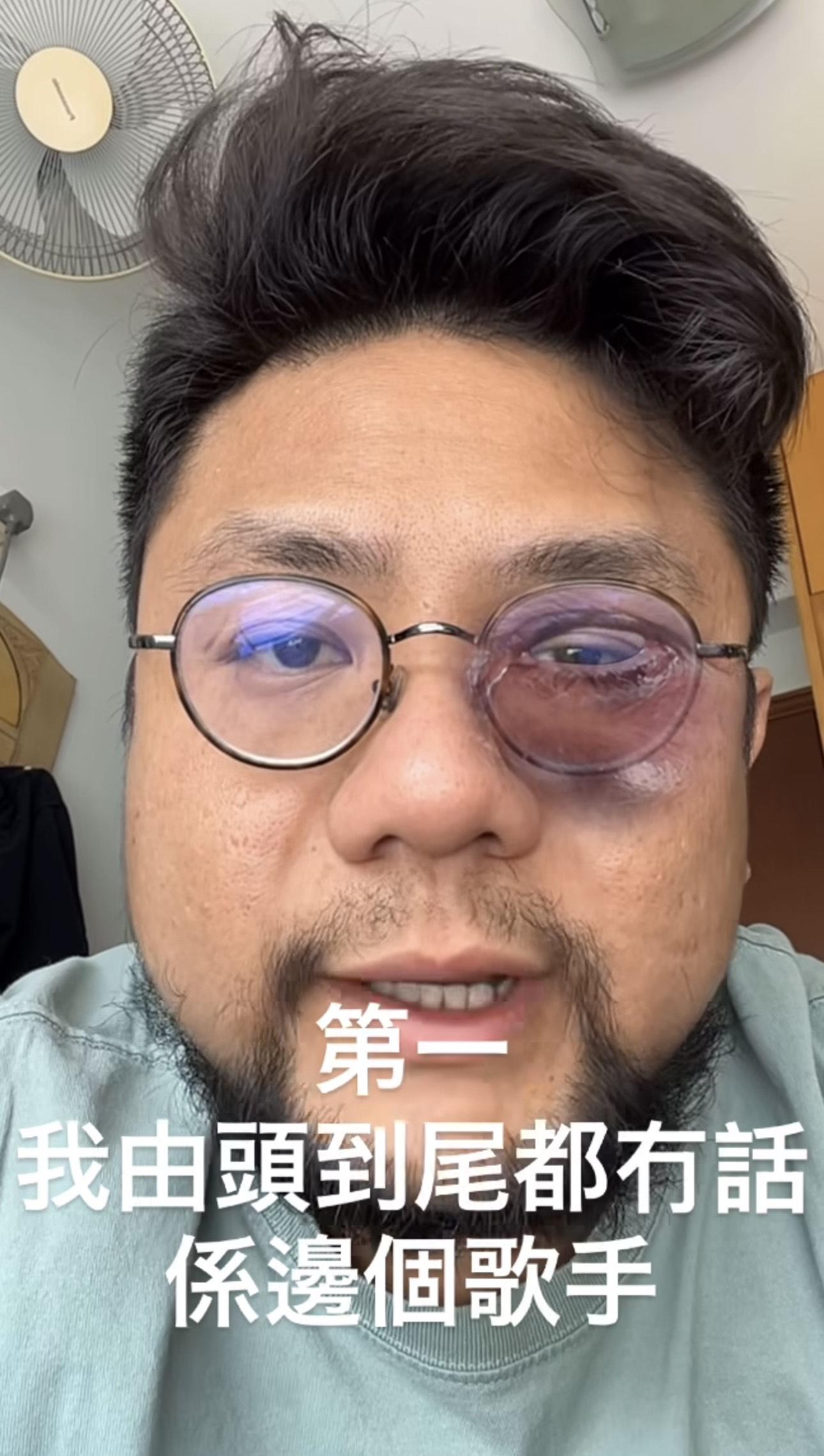 網紅坦言無諗過短片會咁大迴響。