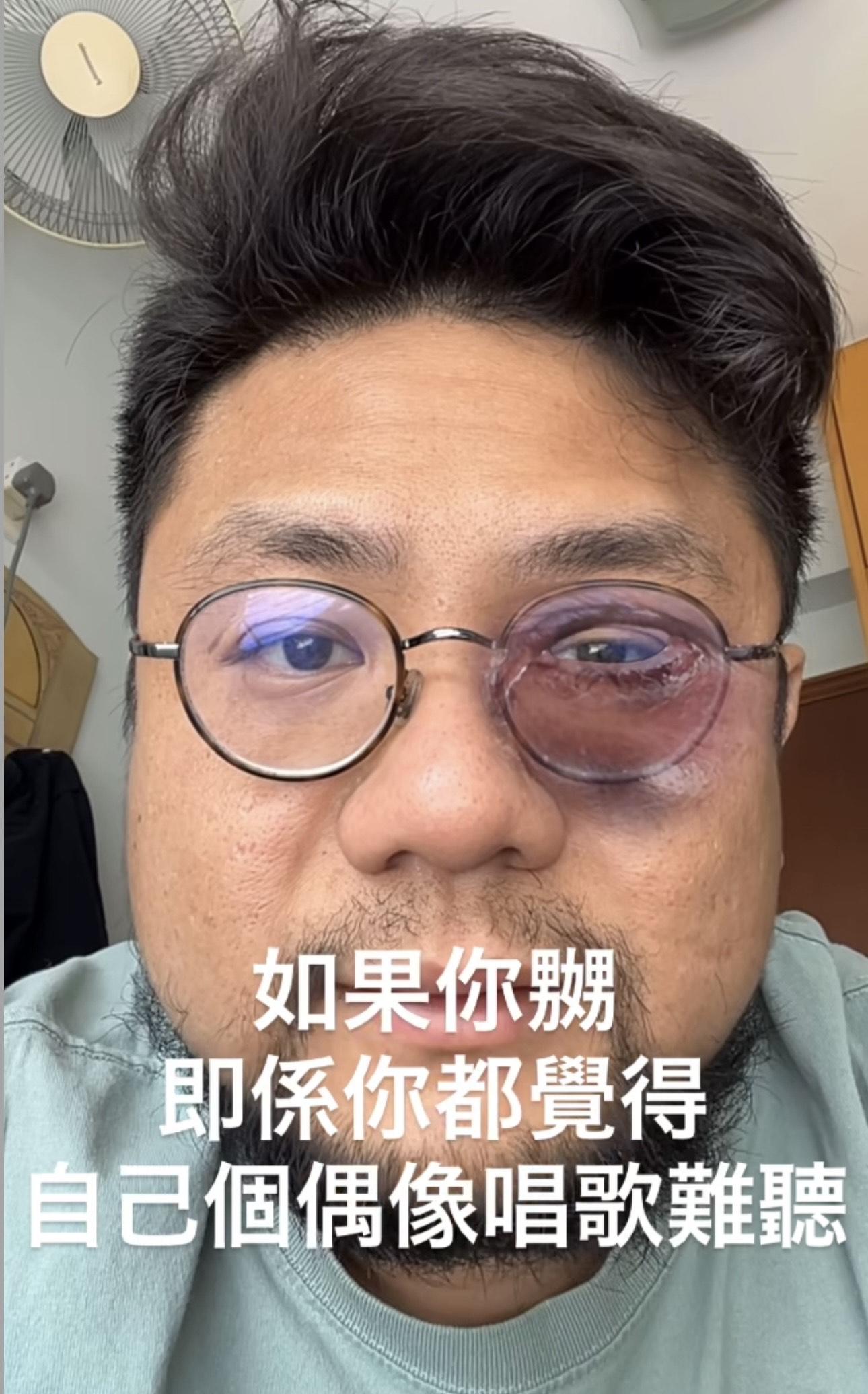 嚴重脂肪哥二世