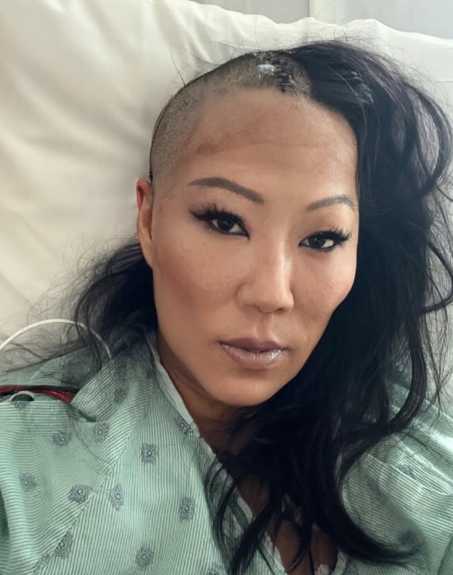 Lynn Ban手術後曾清醒更新社交網,更在病床分享自拍照。