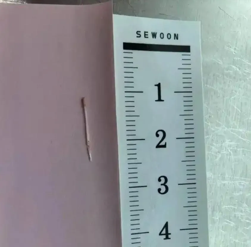 杭州一間醫院除夕夜為鯁魚骨人士拔了17根魚骨。(寧波晚報)