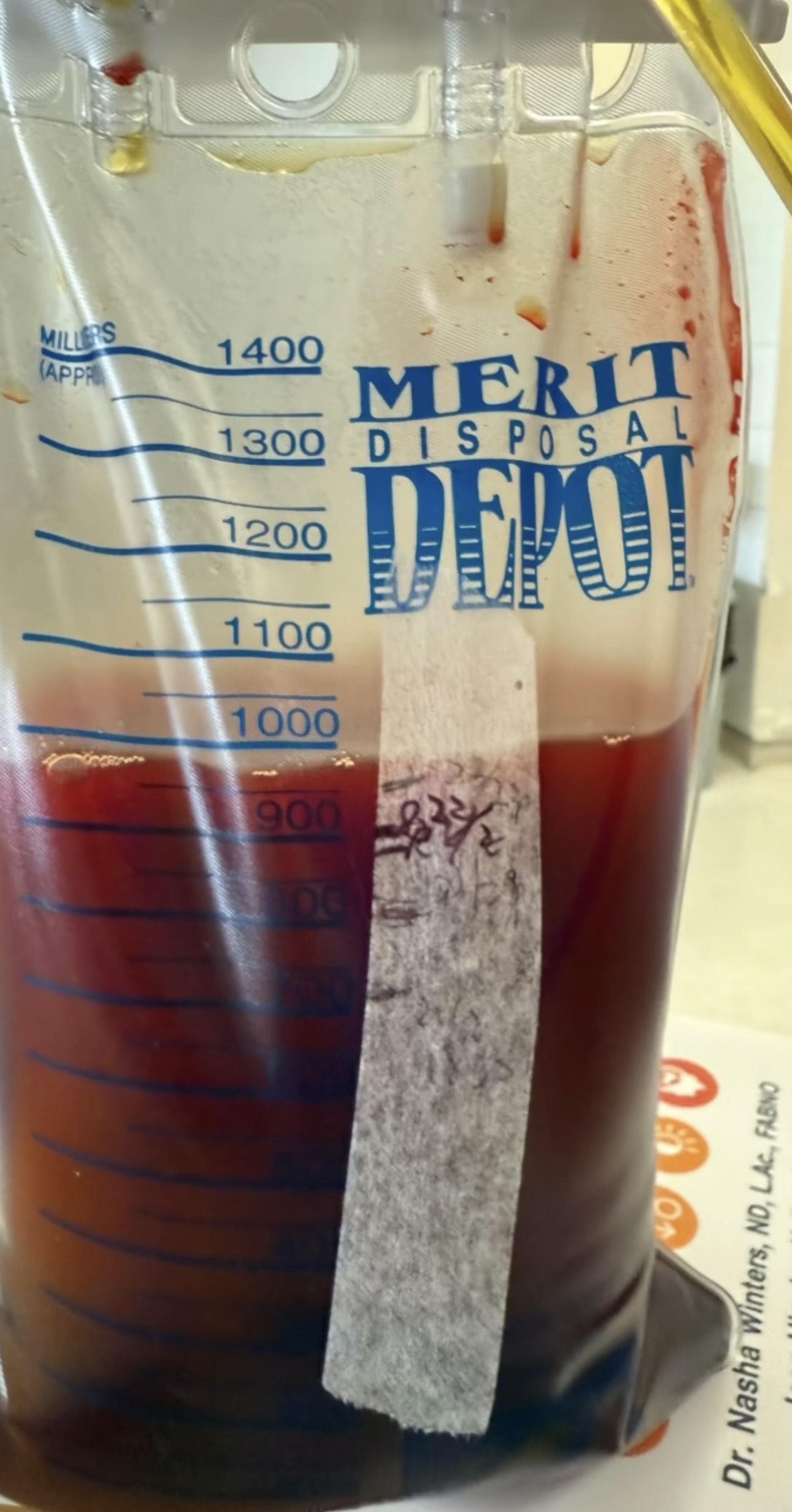 吳文忻上載一袋裝有血紅色液體的照片。