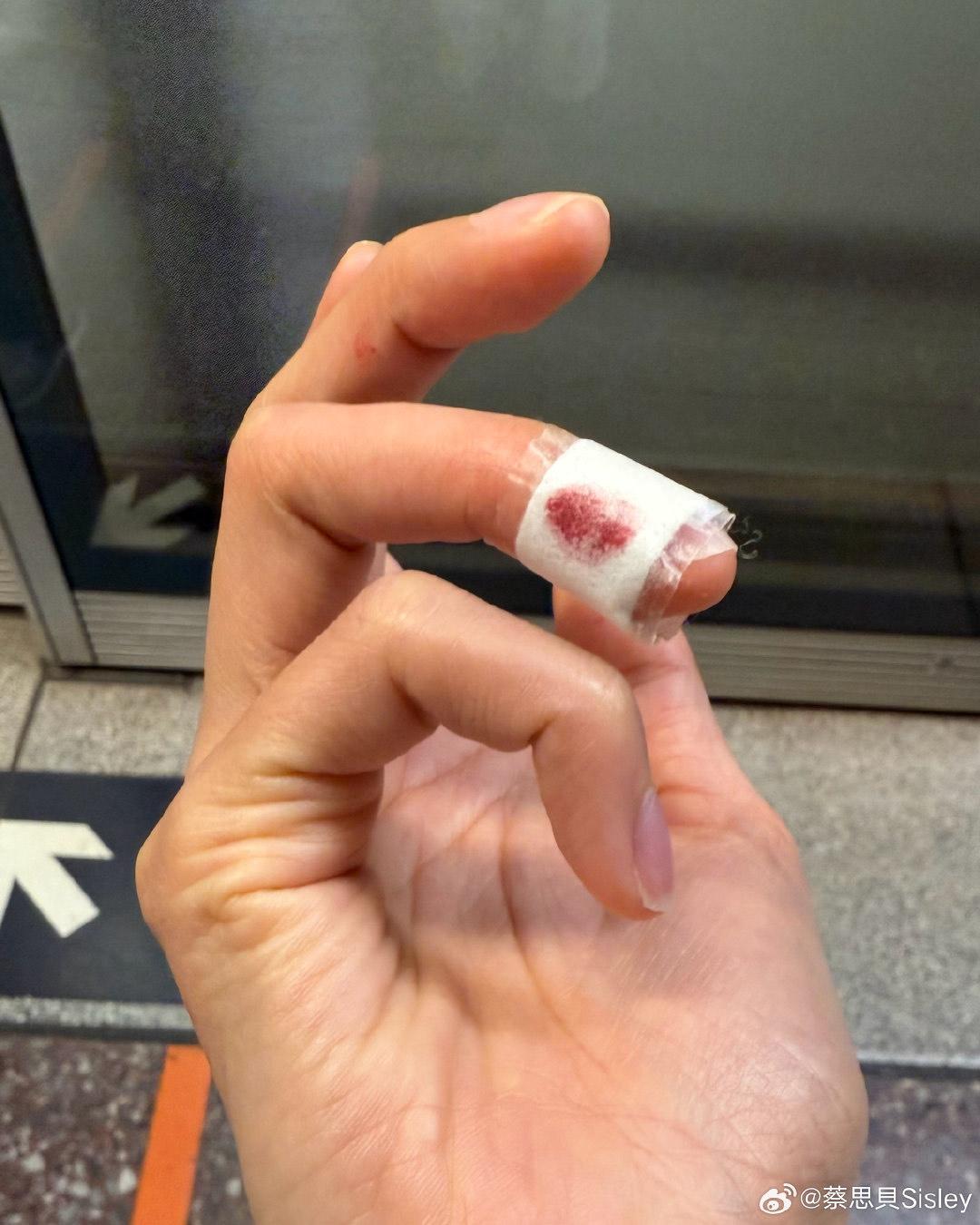 蔡思貝弄傷手指流血。