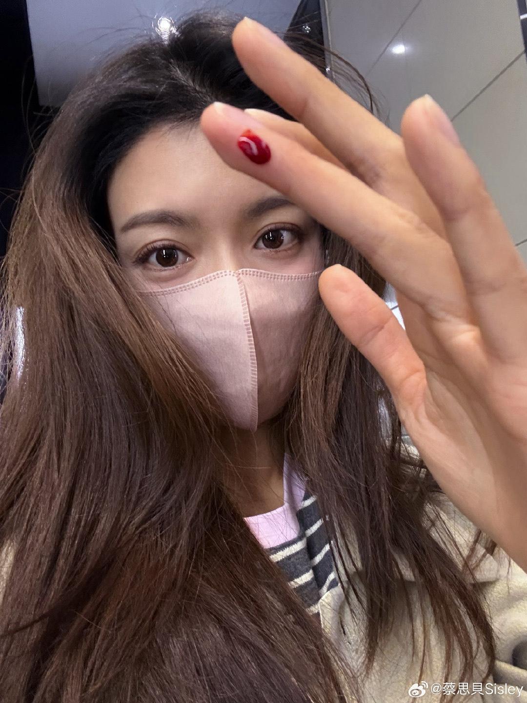 蔡思貝自爆生日遇上血光之災。