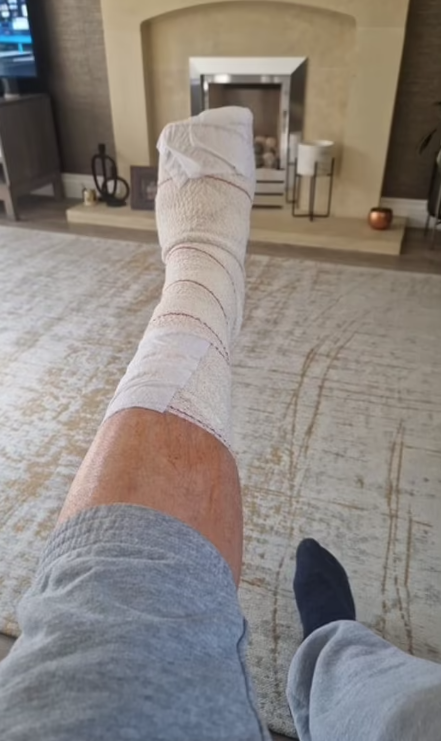 Edges接受手術後現已康復。(互聯網)