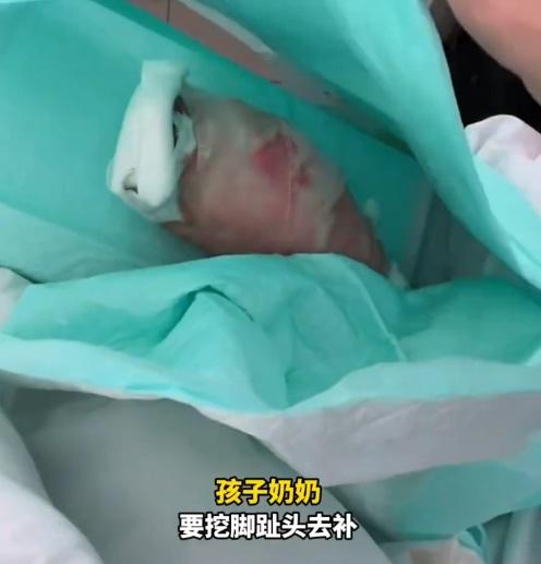 男童的婆婆表示,等男童傷養好了,再挖腳趾頭去補肉。(微博)