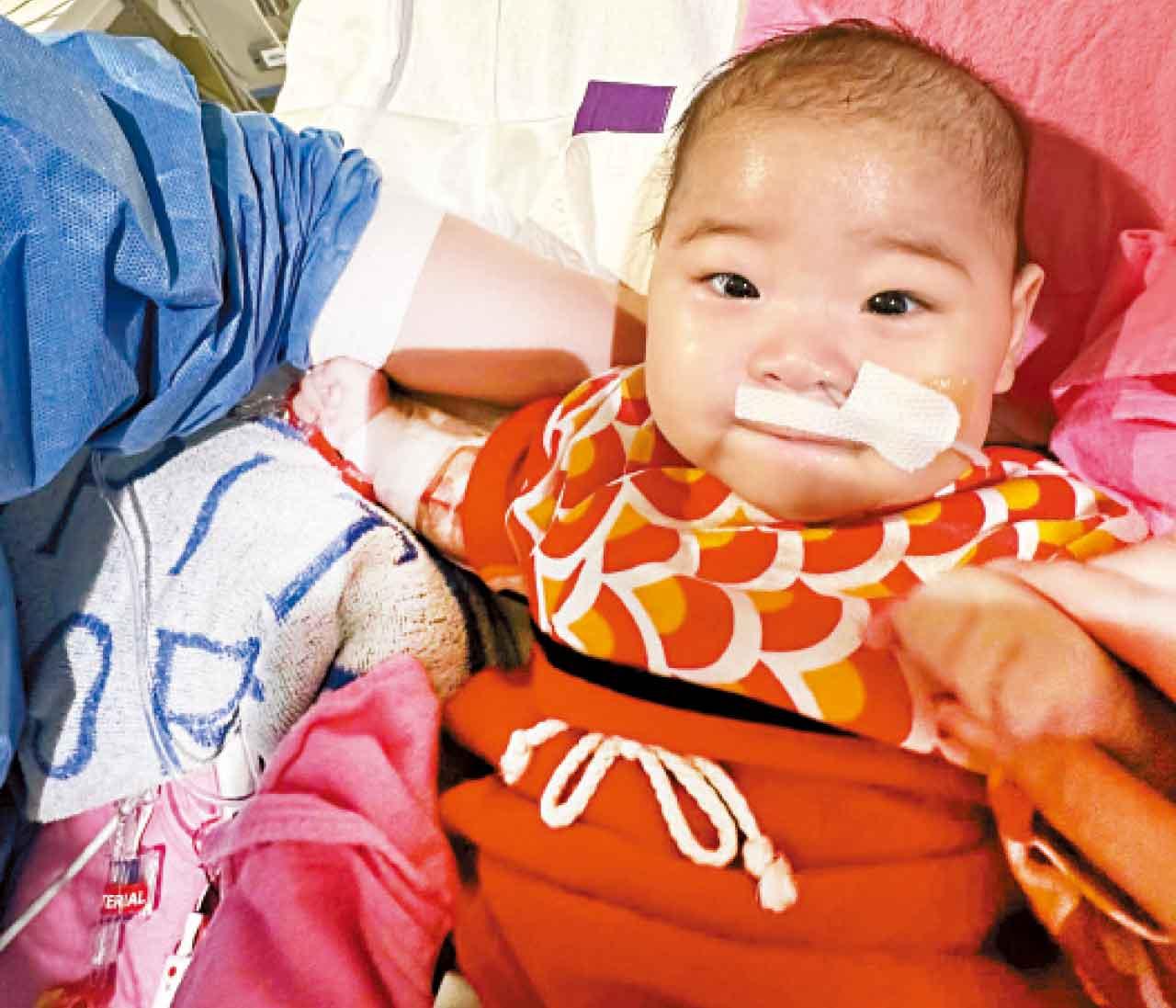 女嬰祈祈心臟移植