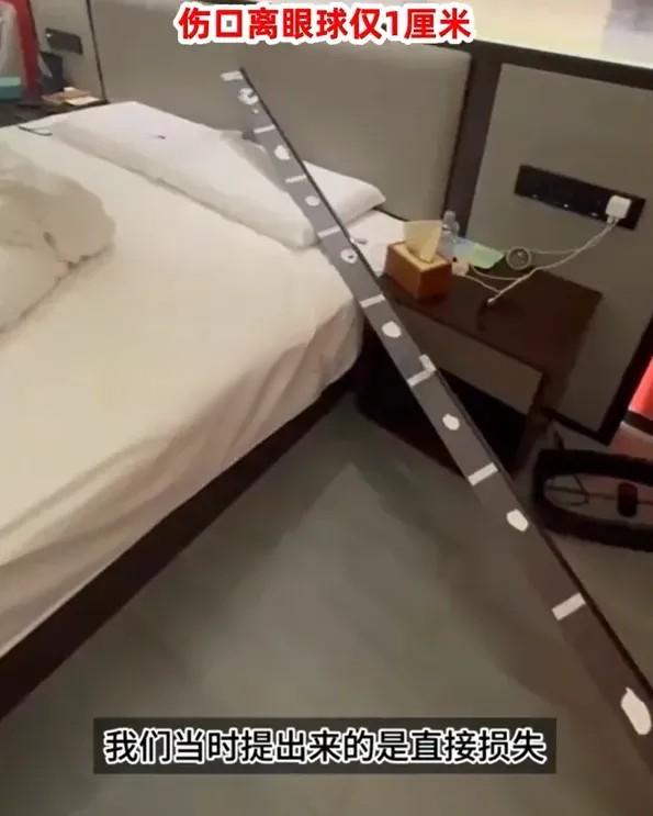 蘇州酒店掉下的金屬吊頂。(黑貓投訴)