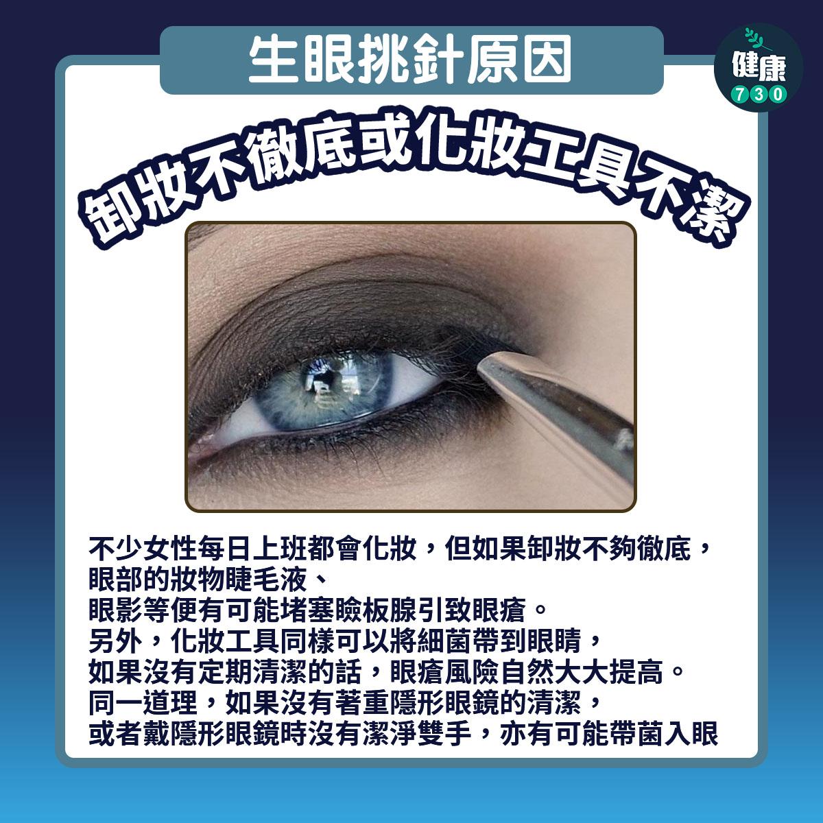 生眼挑針原因|卸妝不徹底或化妝工具不潔(am730製圖)