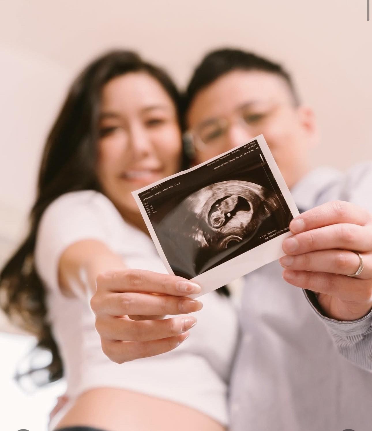 陳詩欣昨日情人節宣布懷孕喜訊。