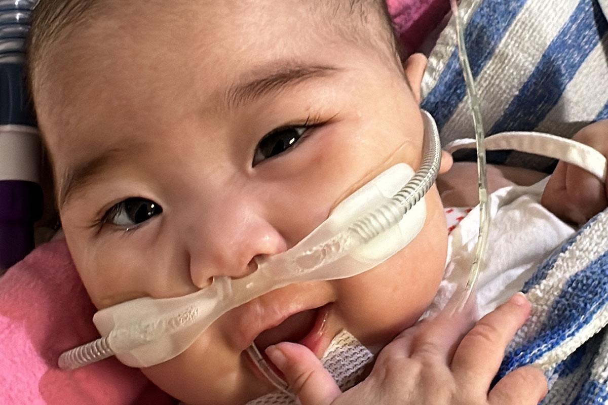 女嬰祈祈獲得內地捐贈心臟並成功移植。(香港兒童醫院提供)