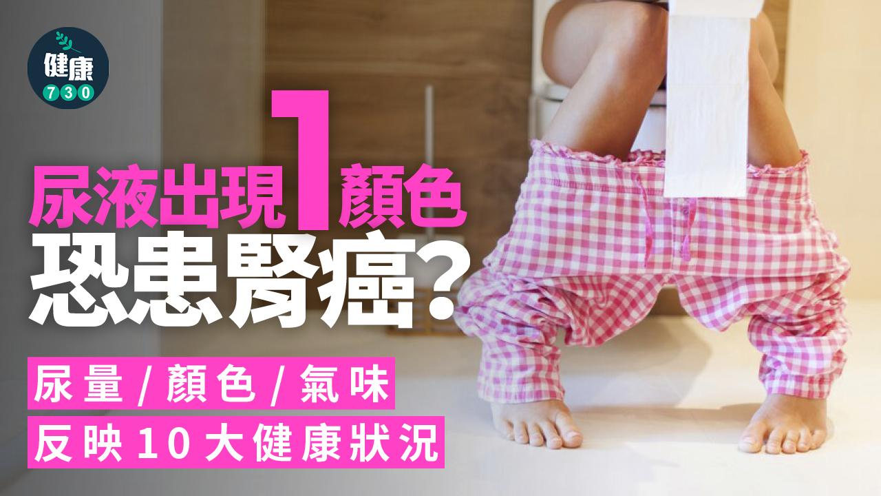 尿液出現1顏色恐患腎癌?醫生揭尿量/顏色/氣味反映10大健康狀況