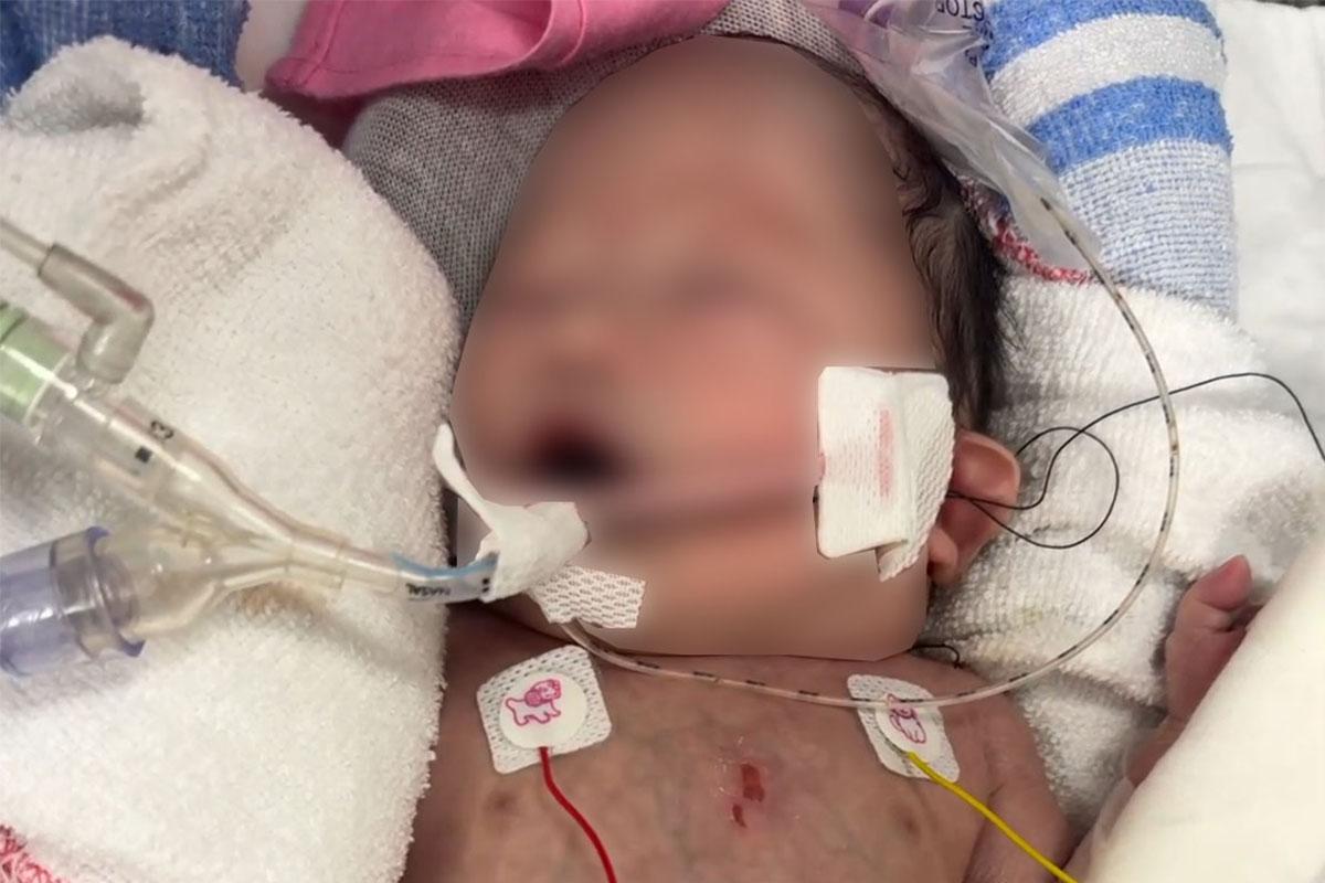 一名男嬰在瑪麗醫院剛出生身體情況危急,須送入兒童深切治療部並接駁人工心肺機續命。(Threads用戶ricky_tse92圖片)