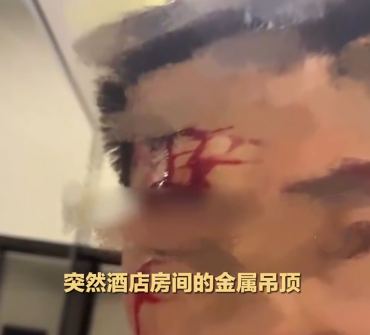 男子半夜被酒店吊頂所傷,索償17萬人民幣。(黑貓投訴)