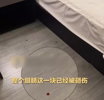 男子受傷後,血滴在房間地板上。