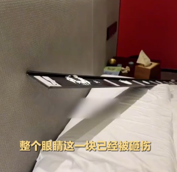 涉事酒店正與受傷住客協商處理方案。