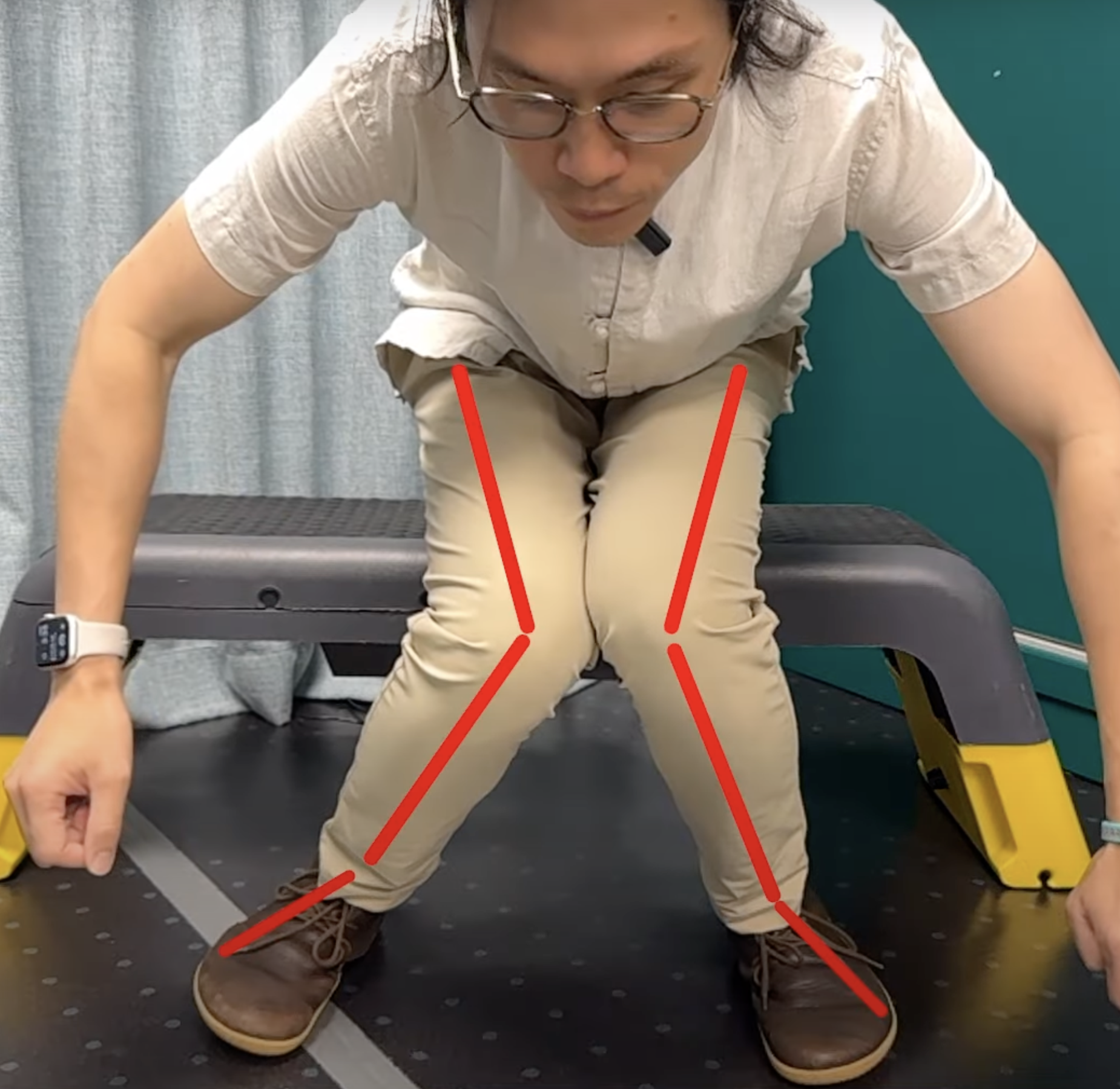 雙腳落地時,由大腿到腳掌不是呈直線,而且膝部位置是向「內拗」(附圖右),此等人士的十字韌帶受傷風險便屬偏高。