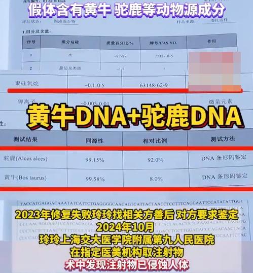 檢測機構在玲玲體內的注射物中檢出聚矽氧烷假體,以及駝鹿、黃牛的DNA。(微博)
