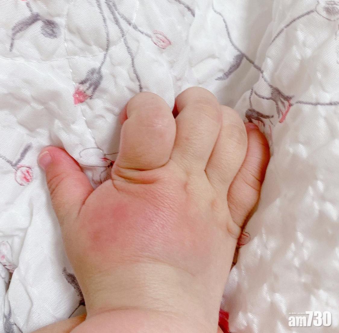 防蚊貼士:被蚊叮咬的位置可以用迷迭香製成的蚊膏舒緩。