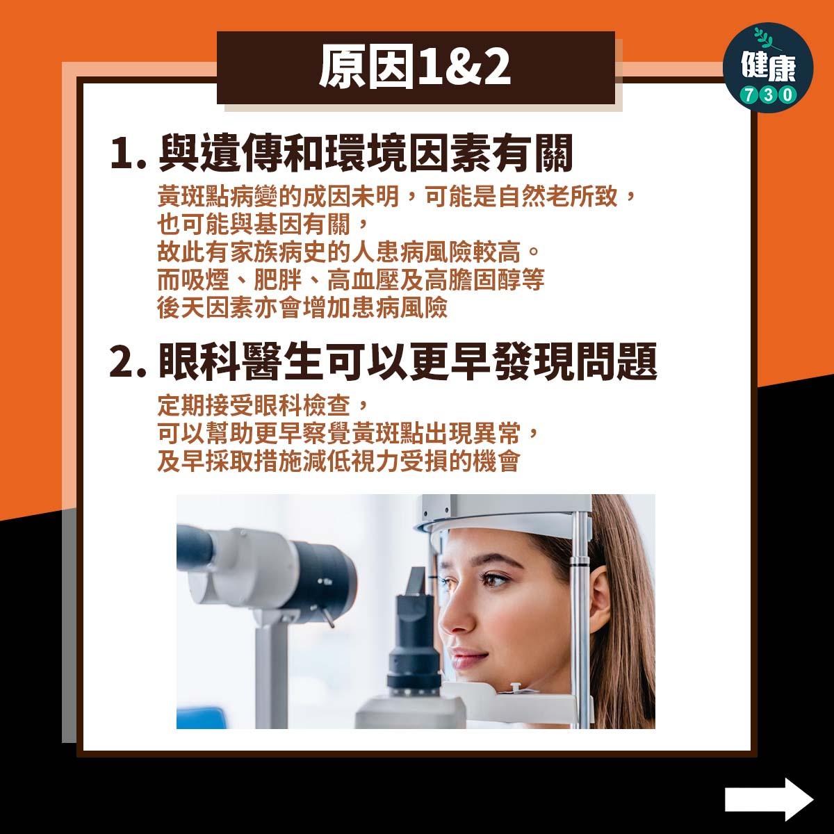 黃斑點病變原因|遺傳與環境(am730製圖)