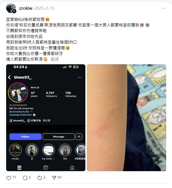 Zoki在網上展示傷勢,稱遭Andy刻意撞傷。