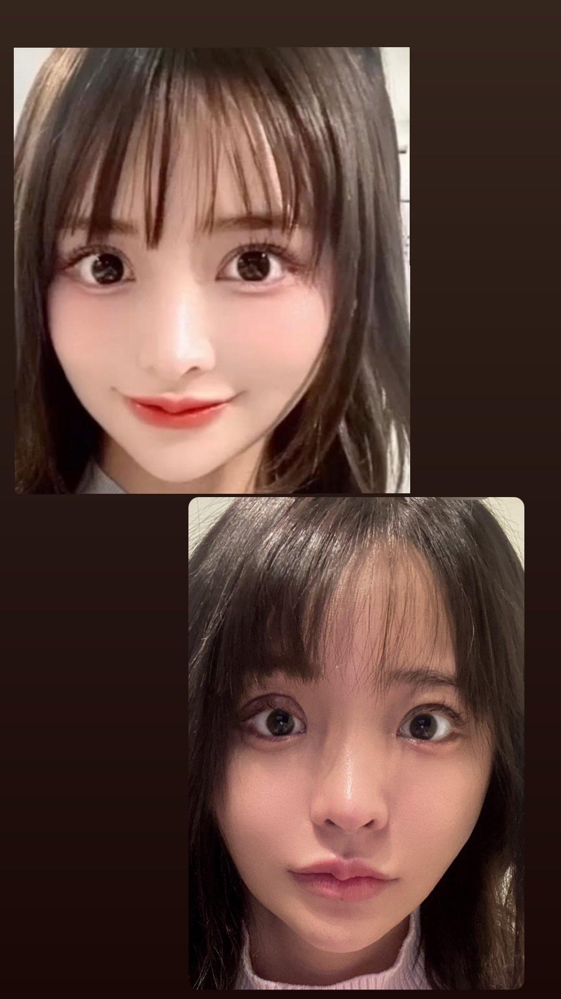 白浜希約1年前在東京銀座的著名整形醫院開刀「微調」,並加錢叫院長親自操刀,點知手術結果不似預期,本來加深雙眼皮變成「三眼皮」,嚴重影響工作。