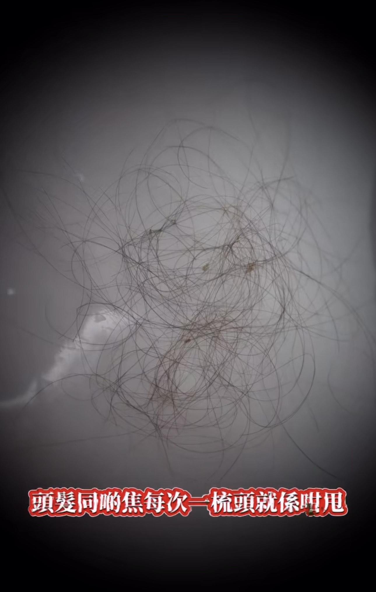 五索表示每一日梳頭,就甩到成地頭髮。