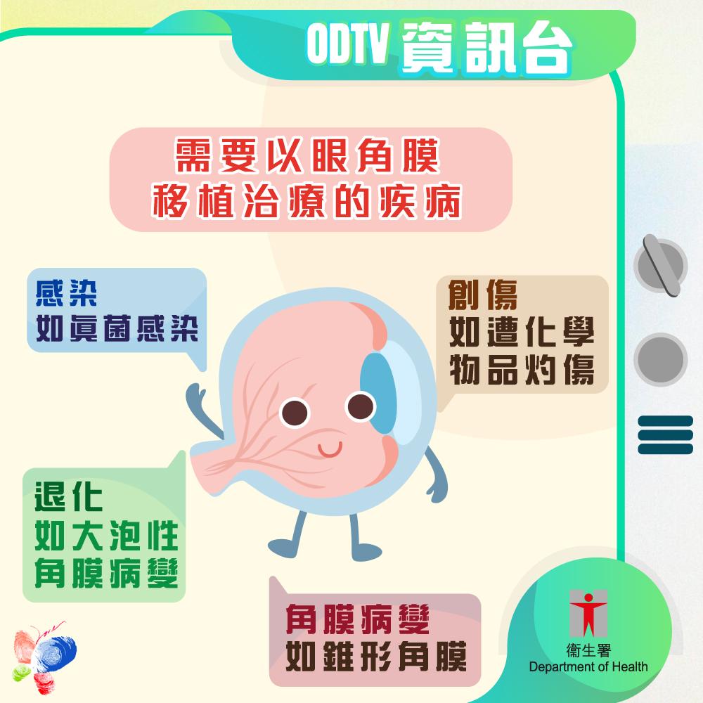 器官捐贈|需要以眼角膜植治療的疾病。(器官捐贈在香港)