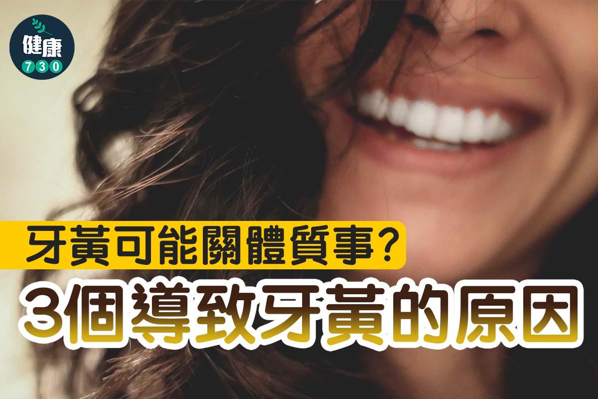 牙黃原因|可能關體質事?(am730製圖)