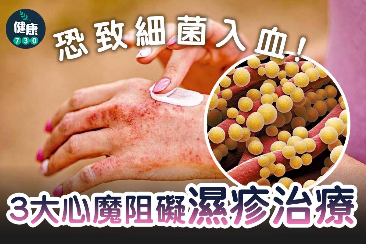 3大心魔阻礙濕疹治療|恐致細菌入血(am730製圖)