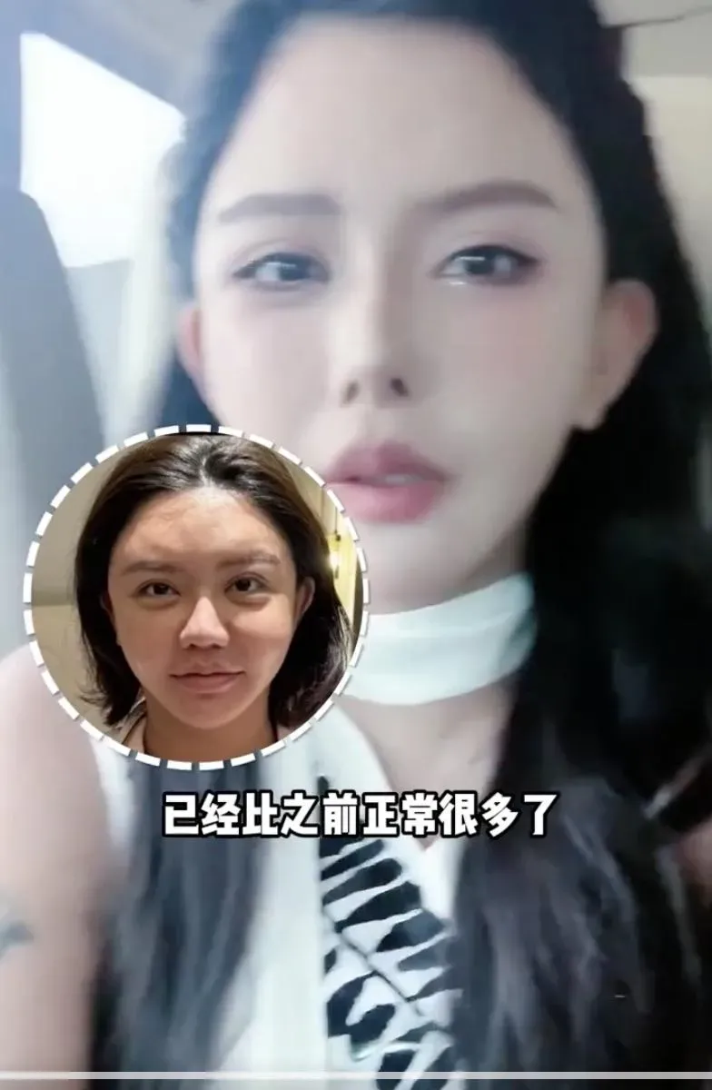 韓安冉整容前後對比。(網上圖片)