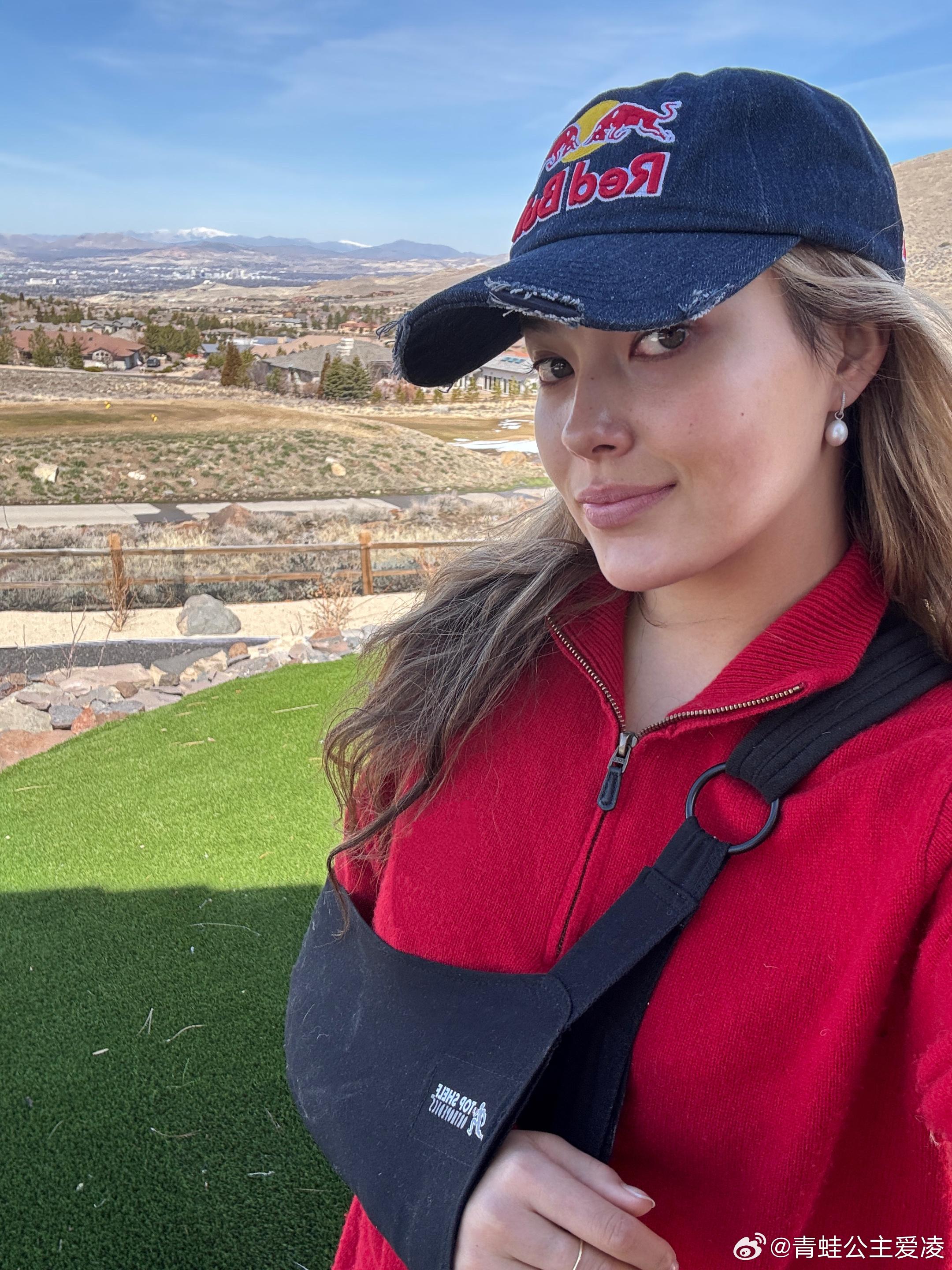 北京冬奧滑雪兩金得主谷愛凌在微博曬出骨折照片。(谷愛凌微博)