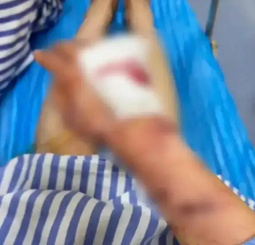 陳女右手傷勢最重,手筋被切斷無法正常工作。(圖/翻攝杭州日報)