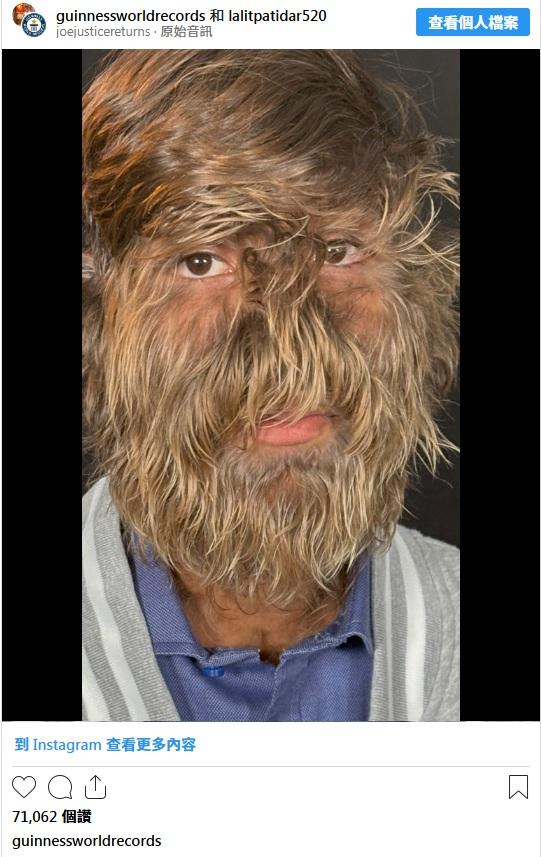 帕蒂達爾在IG上傳影片,分享創下健力士世界紀錄的感受。(互聯網)