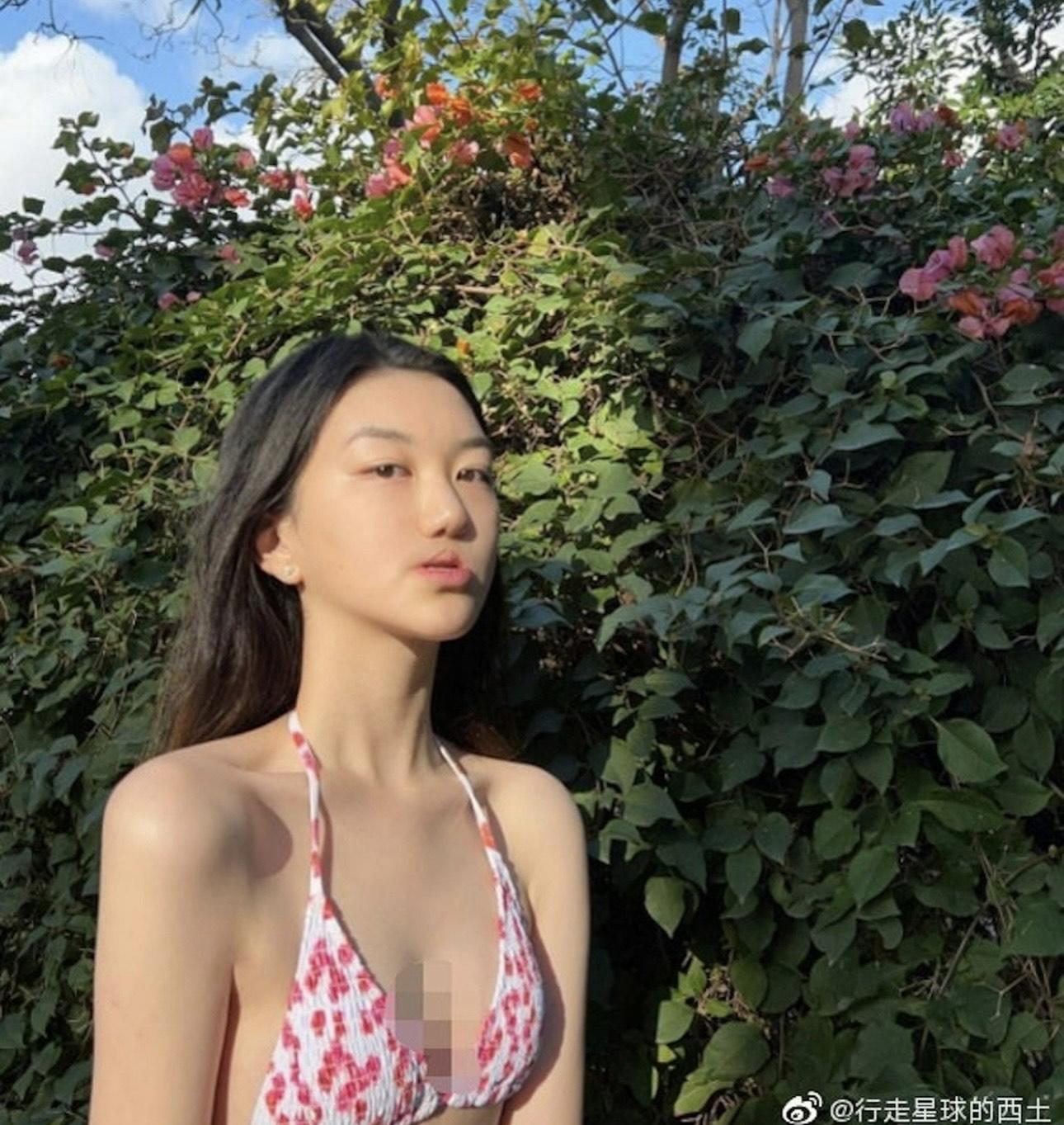 李嫣出世時曾患兔唇,先後接受三次手術治療。