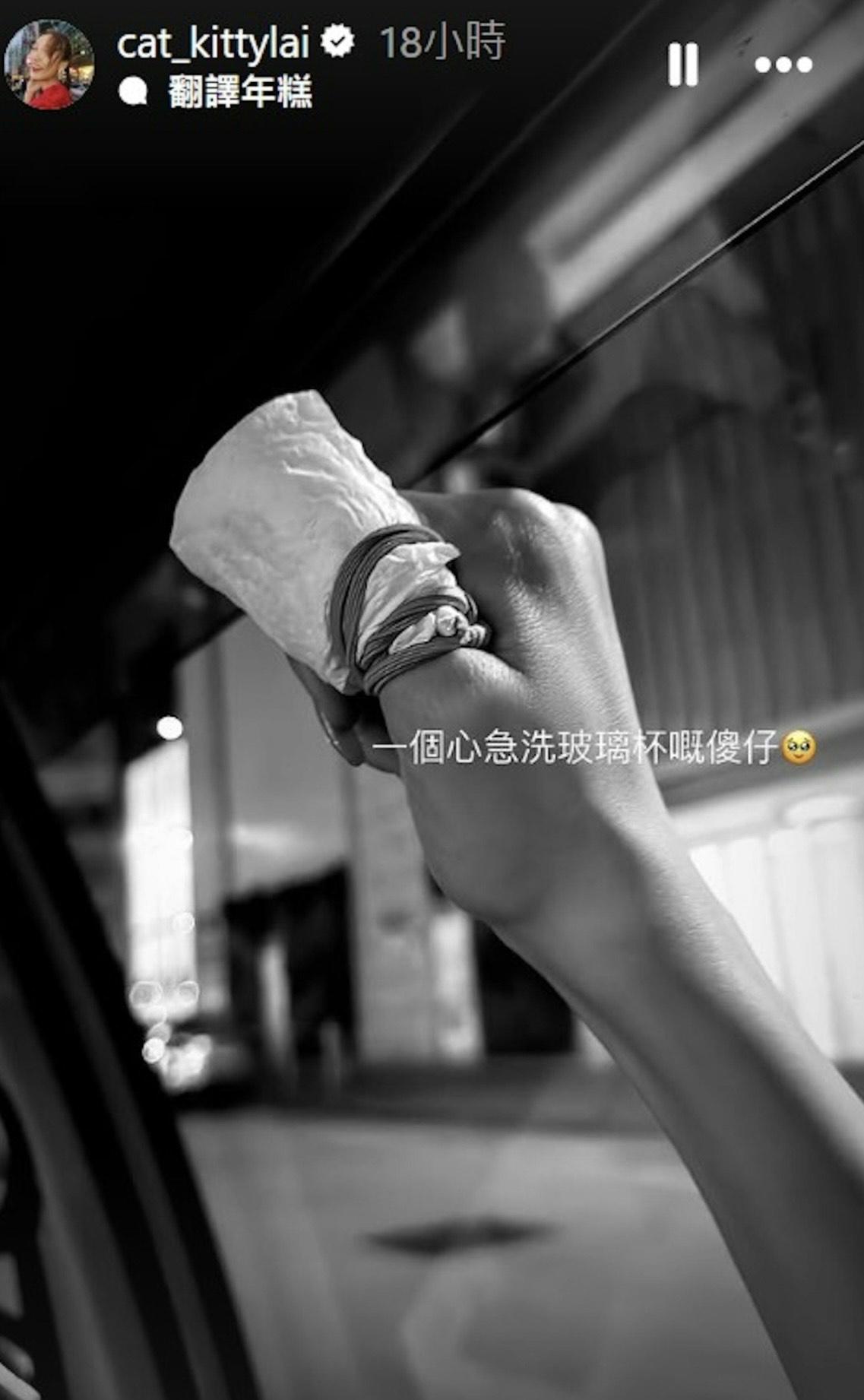 黎寬怡日前發生家居意外,流血不止要到醫院求醫。