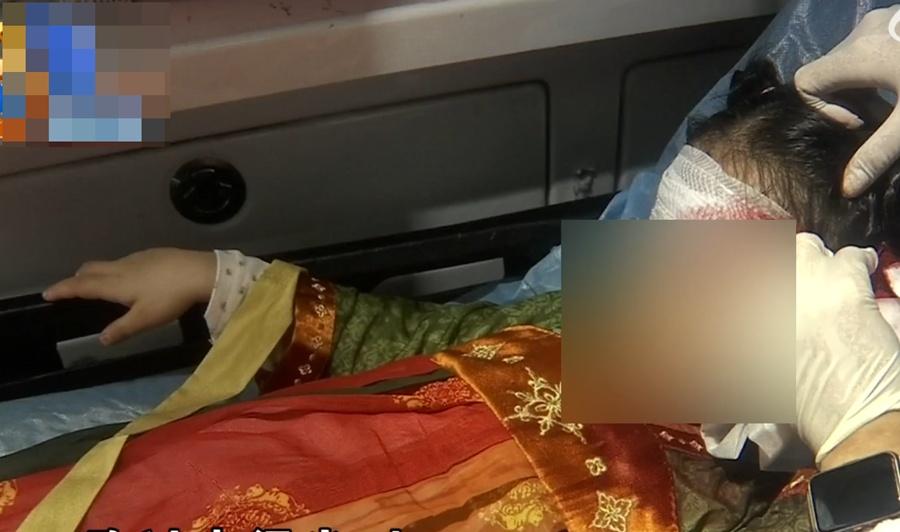 女童送院後足足縫了20針。(微博)