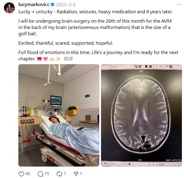 上月6日,Lucy曾在社交平台Threads表示,她將接受腦部手術。(IG)