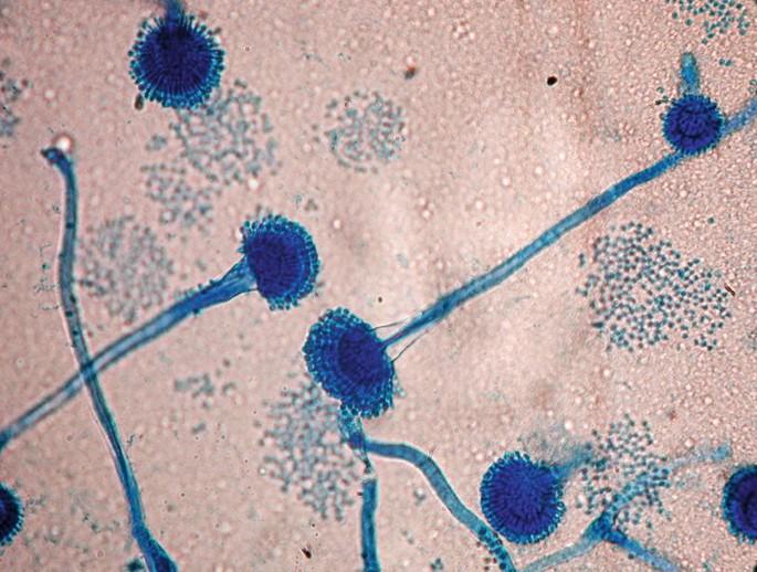 曲霉菌。(網上圖片)